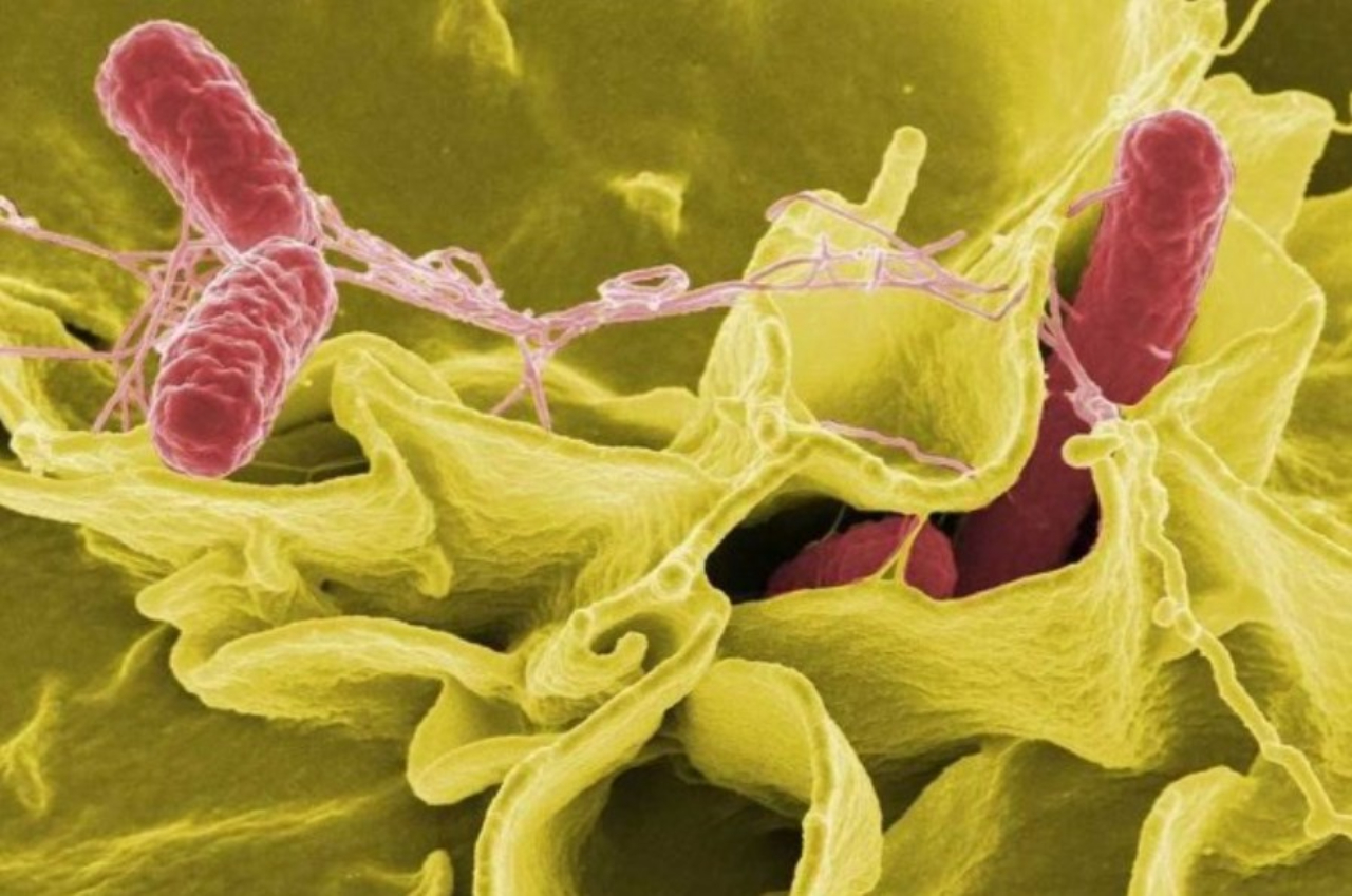 6 Spesies Bakteri Perut yang Berbahaya dan Bisa Sebabkan Diare