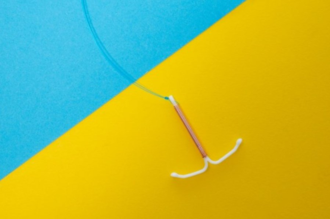 Kenali 7 Kelebihan Kontrasepsi IUD